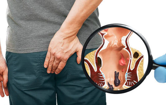 Relieve Piles and Related Symptoms Using Selip