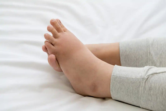 Why You feel puffy in the evening and How to fix It naturally ?